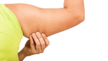 Why are my upper arms flabby?