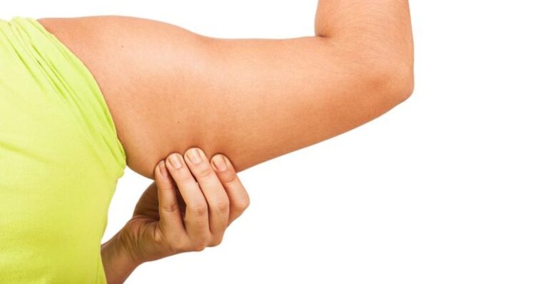 Why are my upper arms flabby?
