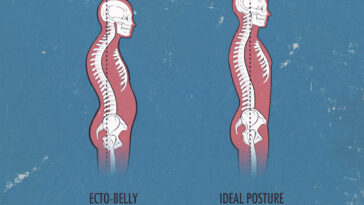 Why do I have a big belly but I'm not fat?