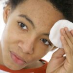 Why do potatoes cause acne?