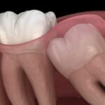 Why does my tooth move when I push on it?