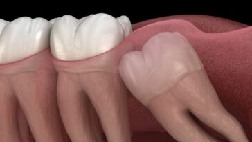 Why does my tooth move when I push on it?