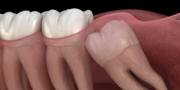 Why does my tooth move when I push on it?