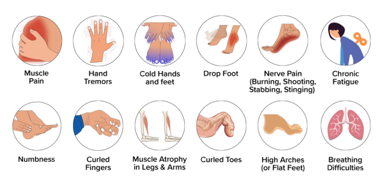 Why is it called Charcot-Marie-Tooth disease?