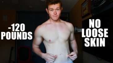 Will I have loose skin after losing 100 pounds?