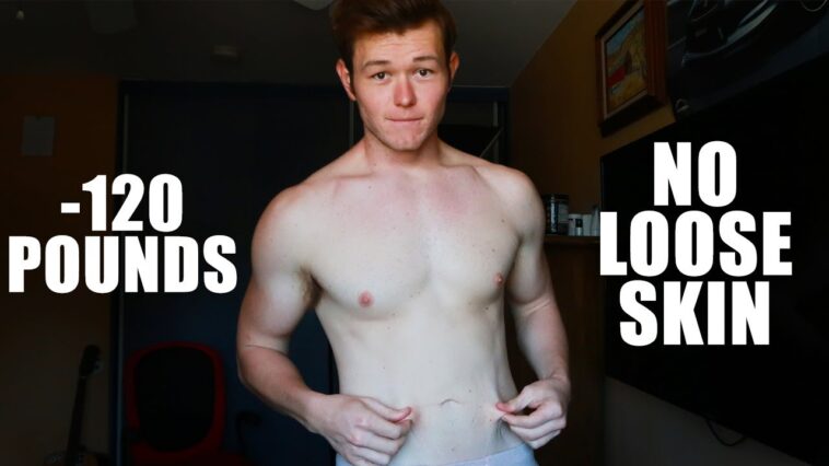 Will a 50 pound weight loss cause loose skin?