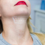 Will losing weight get rid of jowls?