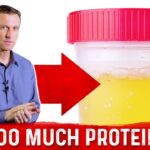 What are the symptoms of too much collagen?