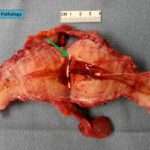 What does mugwort do to the uterus?