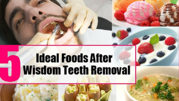 What soft foods can I eat?