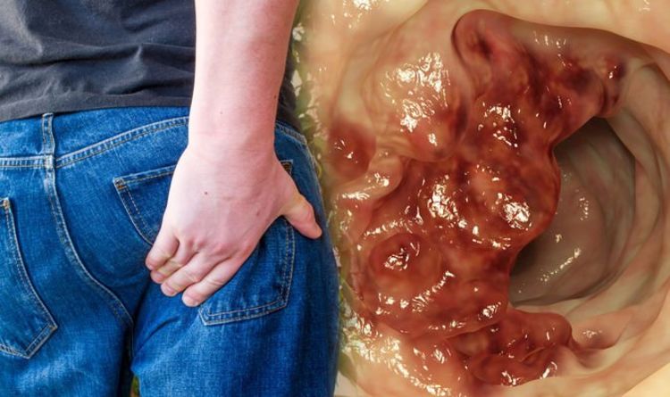 Where is colon cancer pain felt?