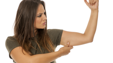 Why do women's arms get fat?